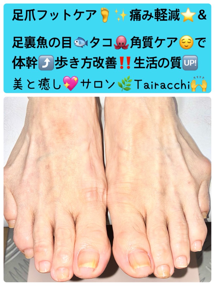 ネイル フットネイル Tairacchi ﾀｲﾗｯﾁのネイルデザイン