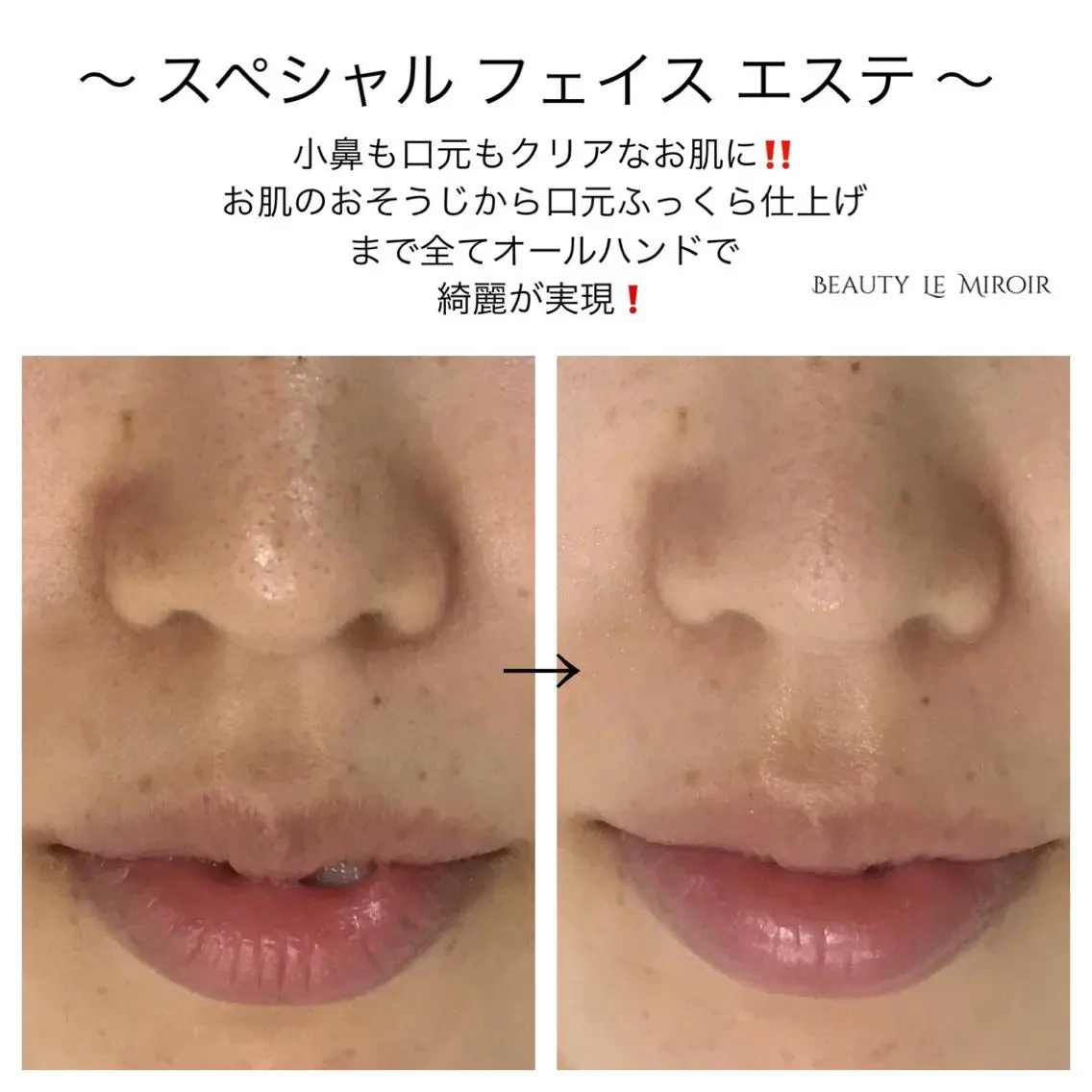 ビューティー ミロワールのエステ・リラクイメージ