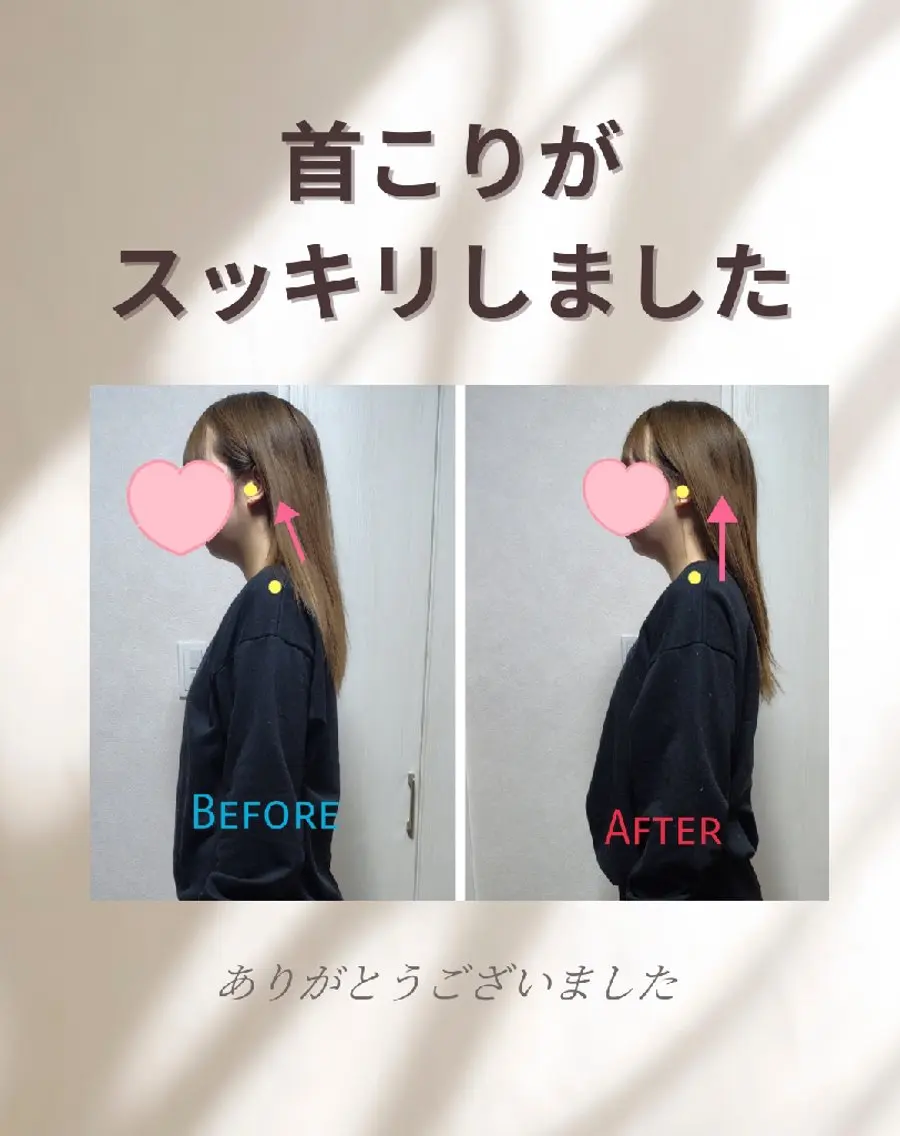 頭痛・首&肩こりのお悩みスッキリコースの写真