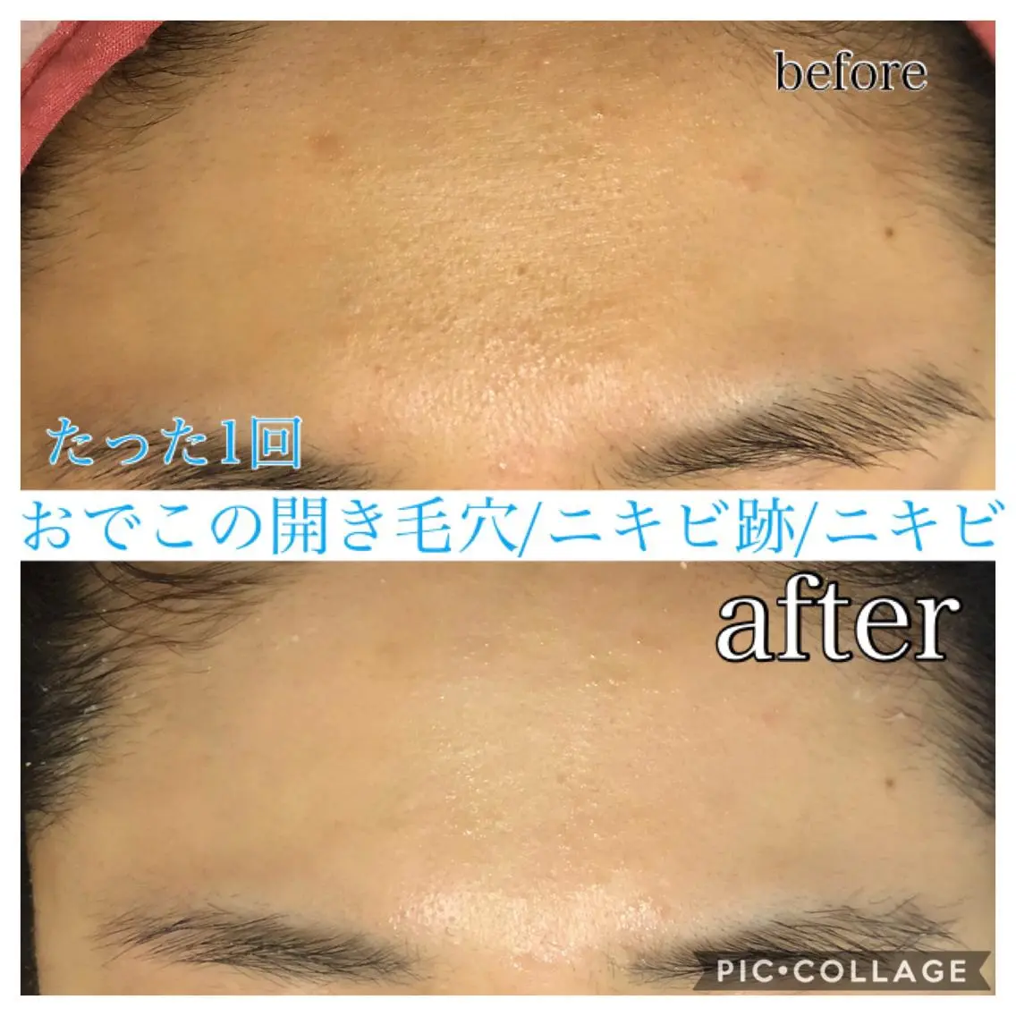 ミディアム カラー パーマ ヘアアレンジ キッズ ネイル マツエク・マツパ エステ リラク EnsorClair 代表　野口真央のエステ・リラクイメージ