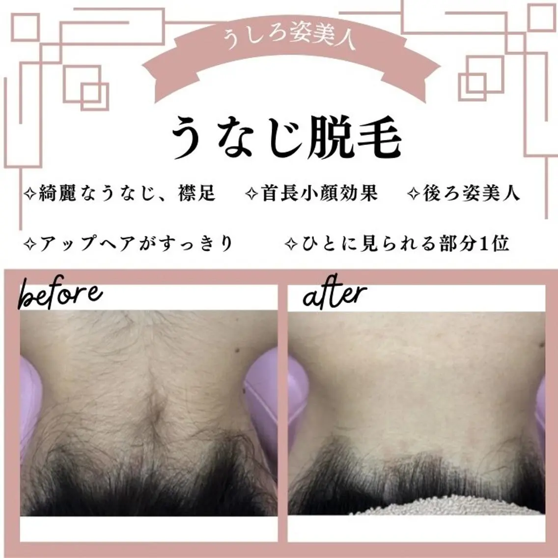 🌷MURA 毛穴・顔脱毛🌷のエステ・リラクイメージ