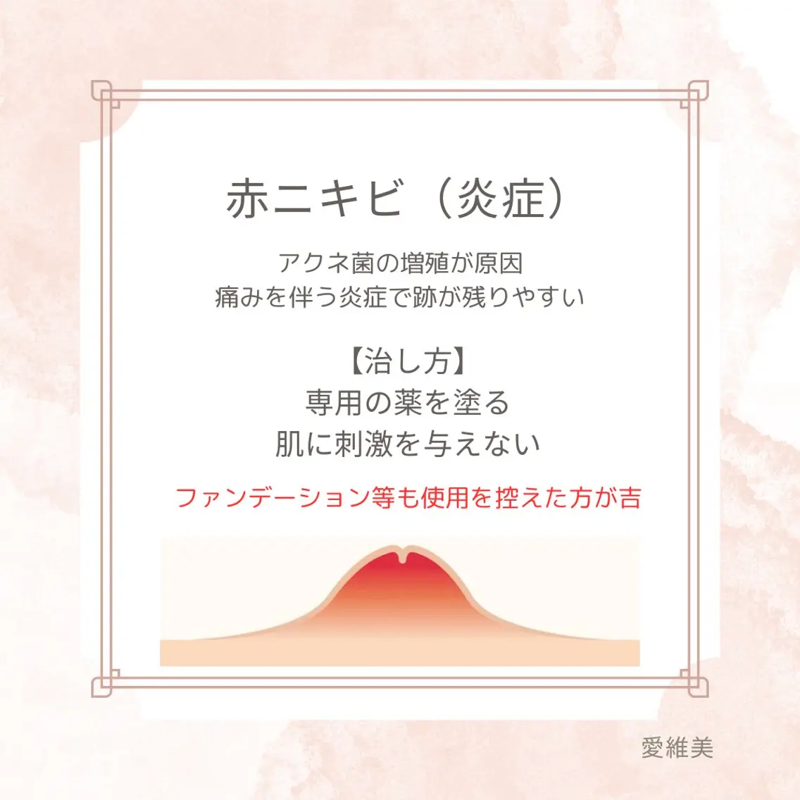 マツエク・マツパ エステ リラク 愛維美水光美肌専門店 メンズレディースokのエステ・リラクイメージ