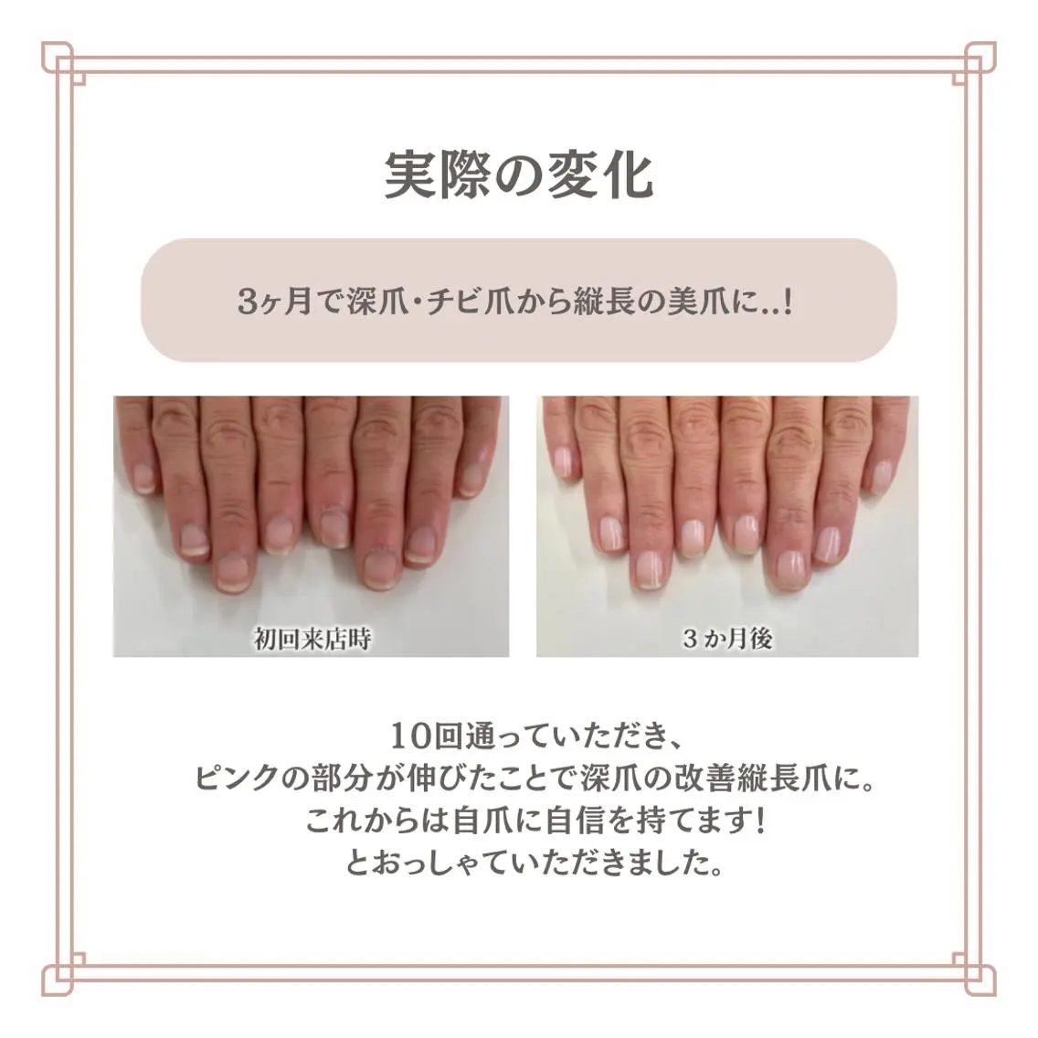 ネイル 自爪育成専門サロン エムロードゥ池下のネイルデザイン