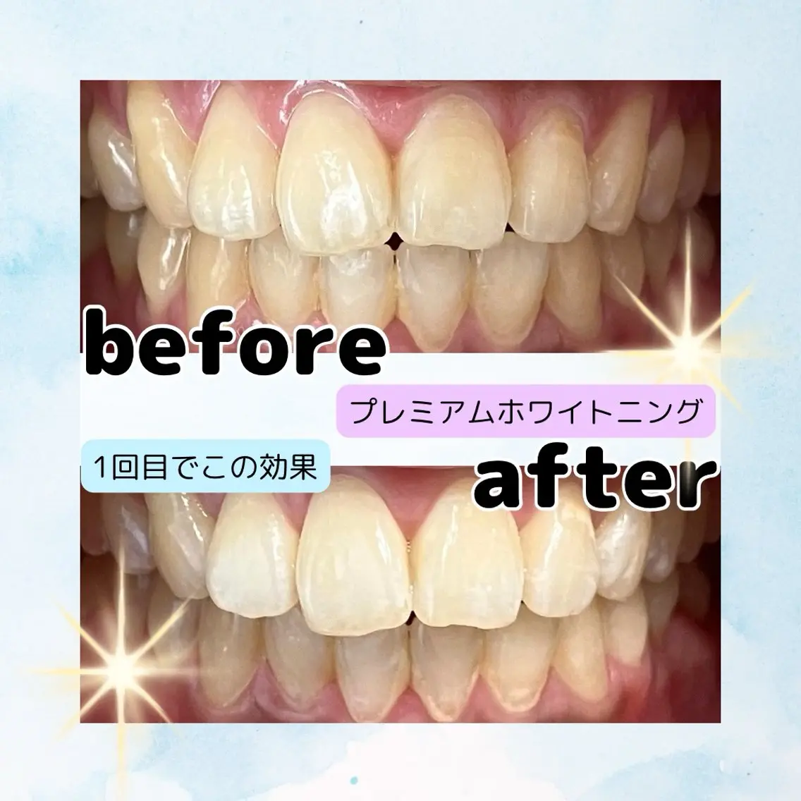 ホワイトニングサロン Soleilのその他イメージ