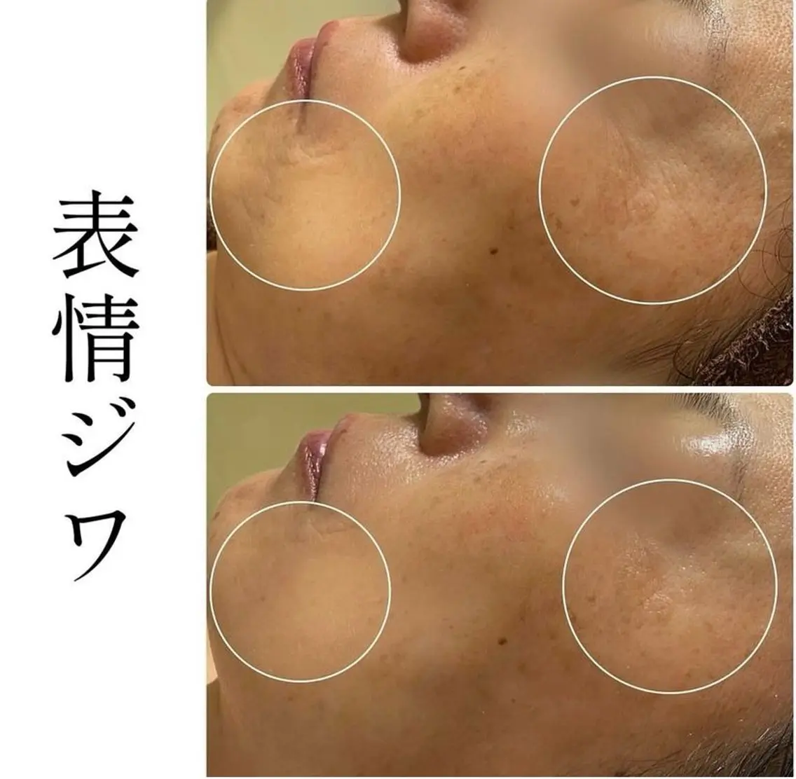 ハーブピーリング専門 BIOPLUS+川崎のエステ・リラクイメージ