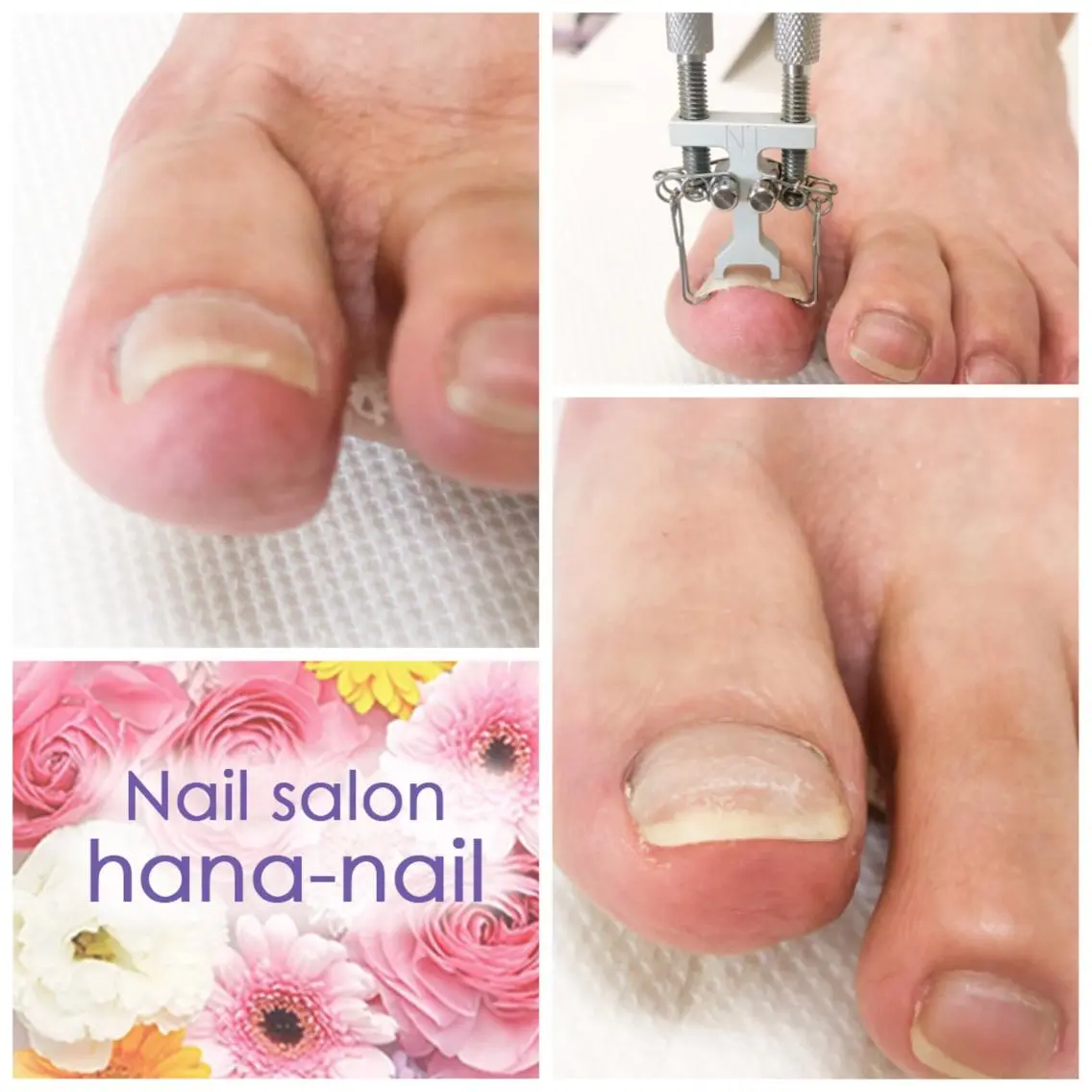 ネイル Kao hana-nailのネイルデザイン