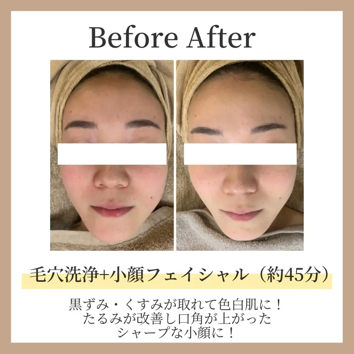 【当店1番人気!!】艶肌3D毛穴洗浄☆＋艶肌小顔フェイシャル（両頬）約45分の写真