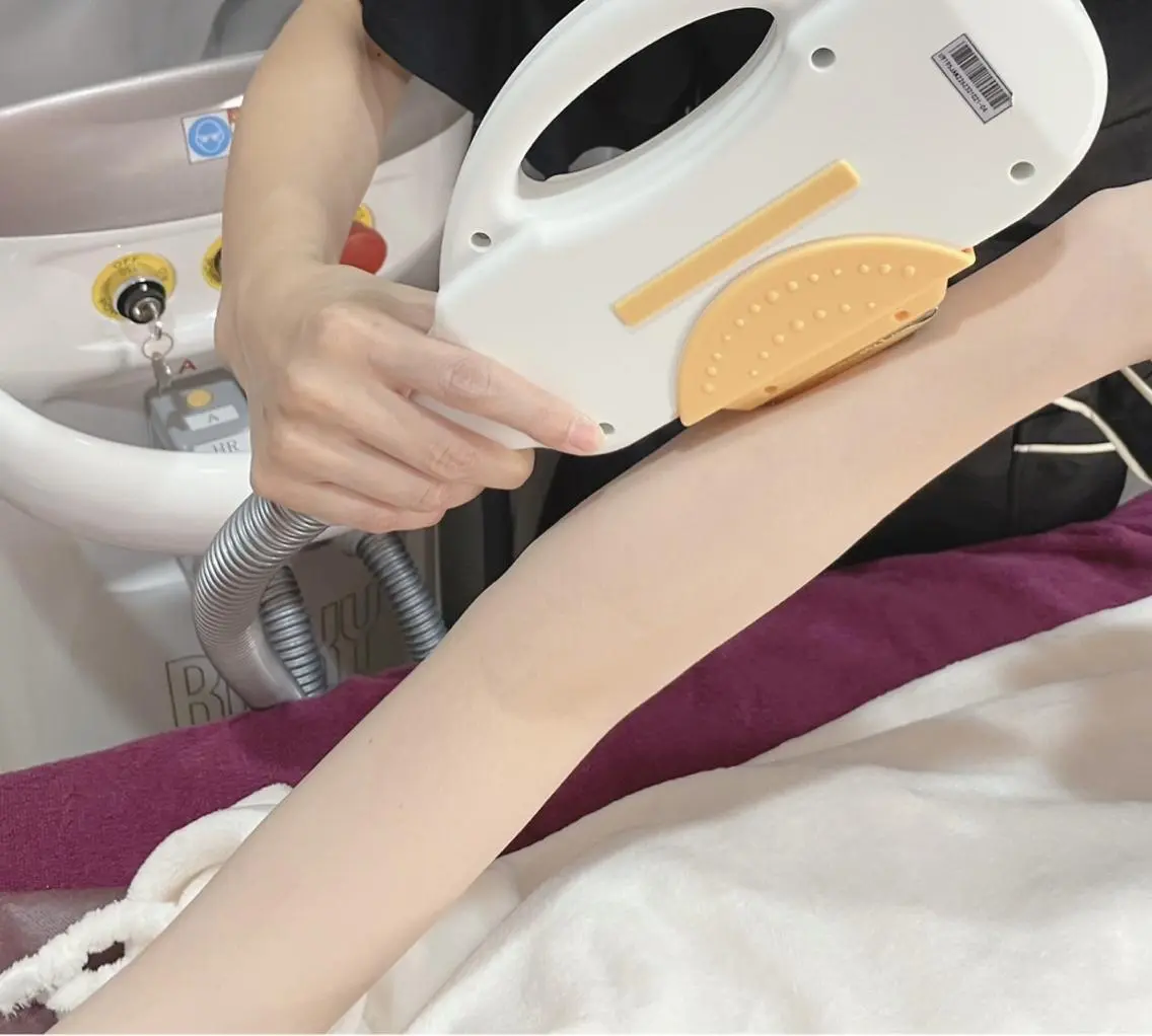 うで下脱毛（ひじ込み）の写真