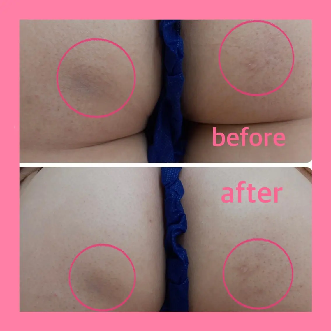 肌ケア＆毛穴洗浄 Cheri/女性専用のエステ・リラクイメージ
