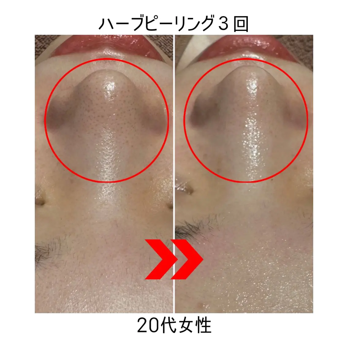 BEXT🌼 土屋のエステ・リラクイメージ