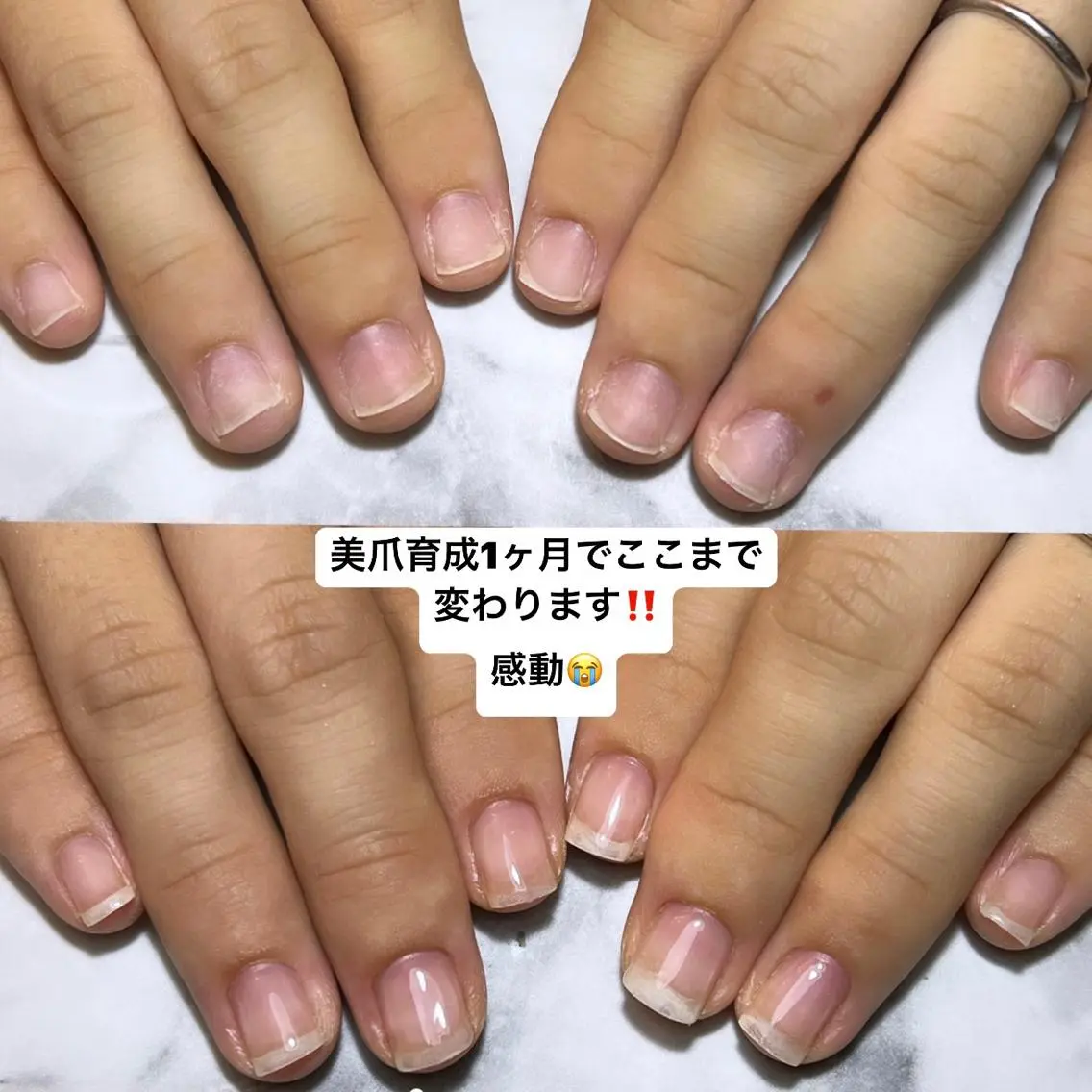 (自爪がすぐ折れて伸ばせない方・深爪)美爪育成コース☆3回分の写真