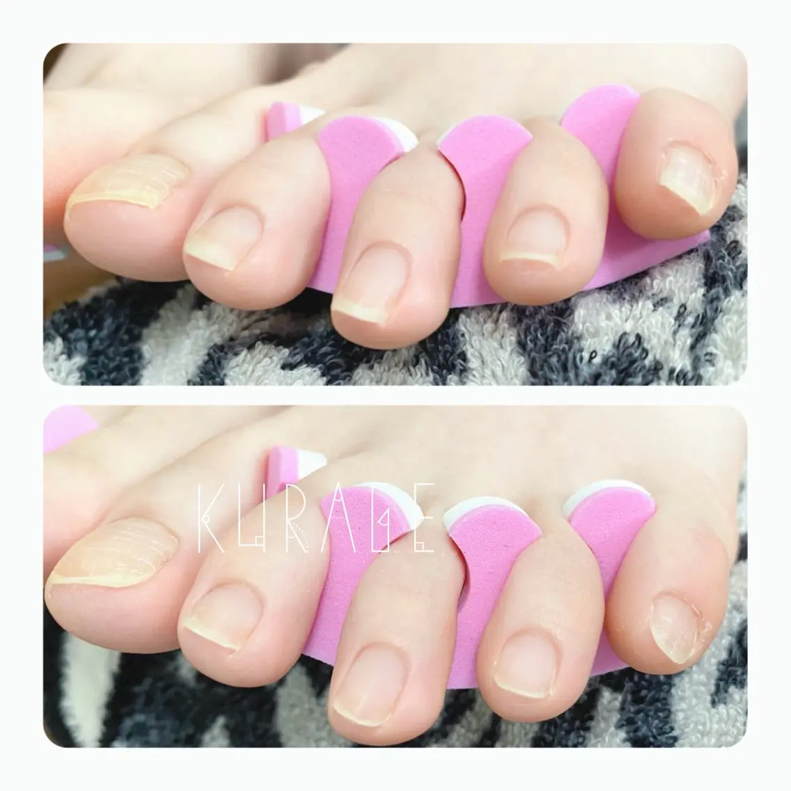 ネイル ジェルネイル その他(ネイル) private salon 海月のネイルデザイン
