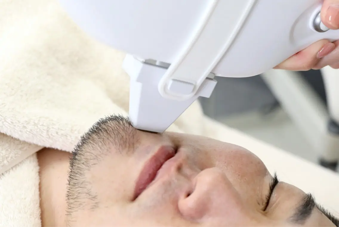 ピンポイント脱毛【100ショット】💡より細かな部位や残った毛にスポットであてたい方向け(髭モードは1回に2ショット要)の写真