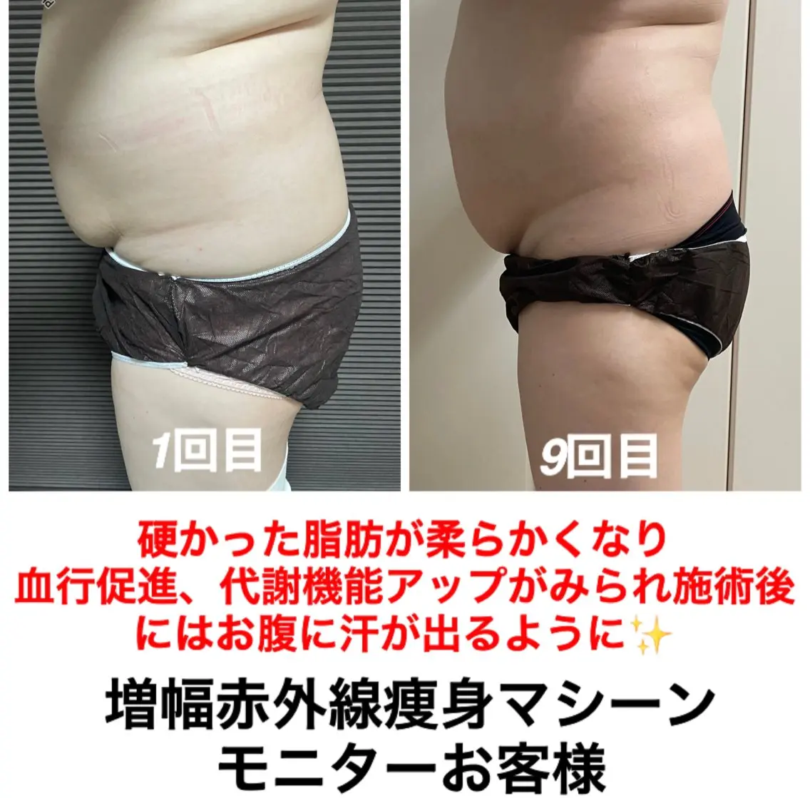 ネイル・エステサロン UILANIのエステ・リラクイメージ