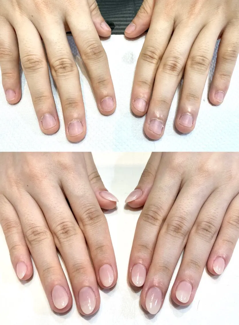 深爪矯正チップ長さ出し10本💅ジェルワンカラー込み3回目まで同額♡の写真