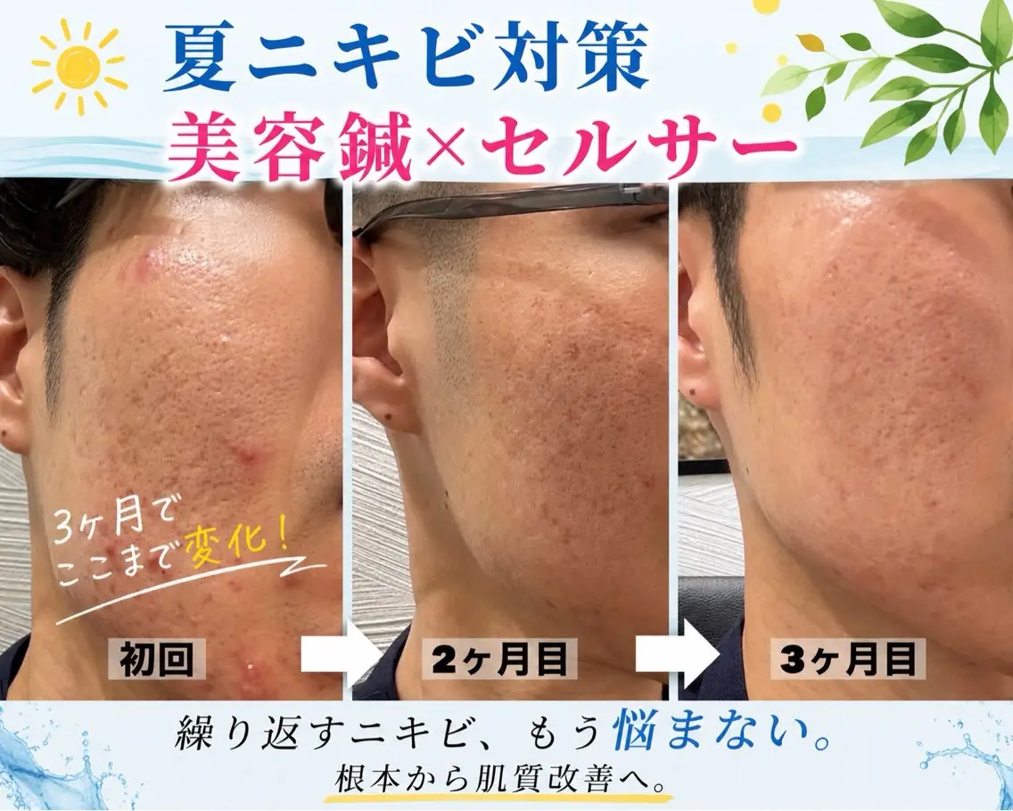 エステ リラク 大阪上本町 肌質改善×美容鍼ゆいのエステ・リラクイメージ