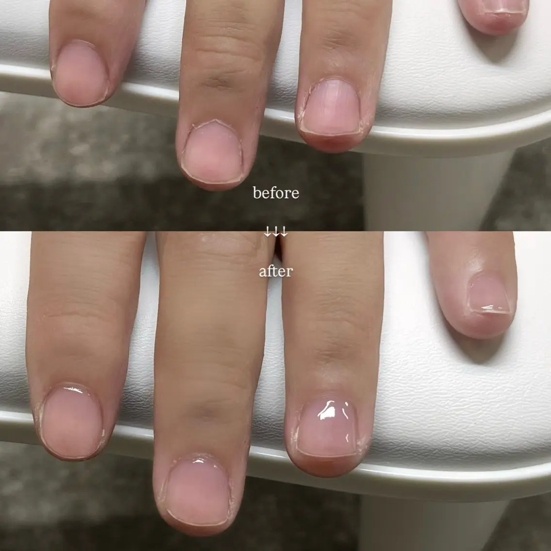 クリアネイルの写真