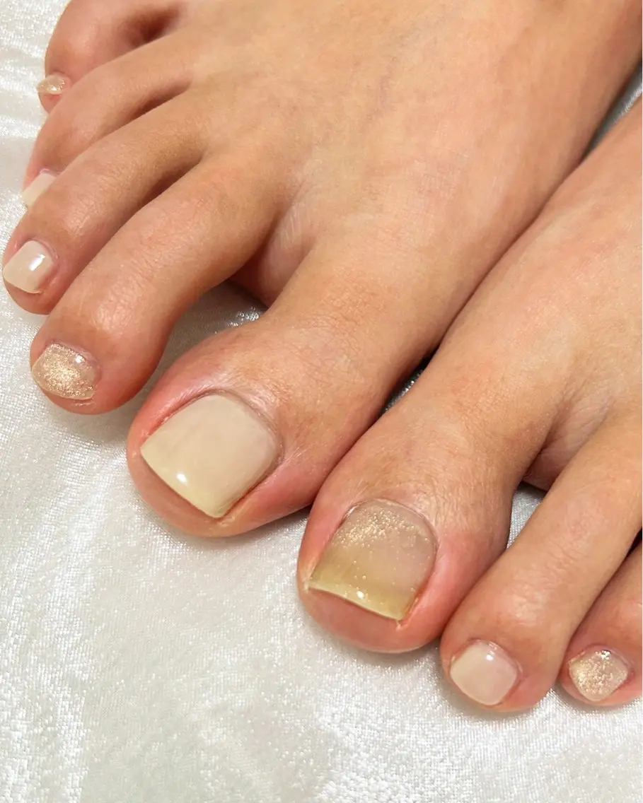 ネイル フットネイル kurumi nail/eyeのネイルデザイン