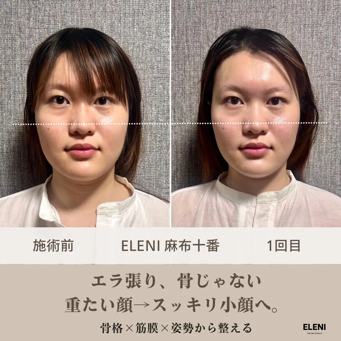 麻布十番小顔コルギ 姿勢矯正リアン💗のエステ・リラクイメージ