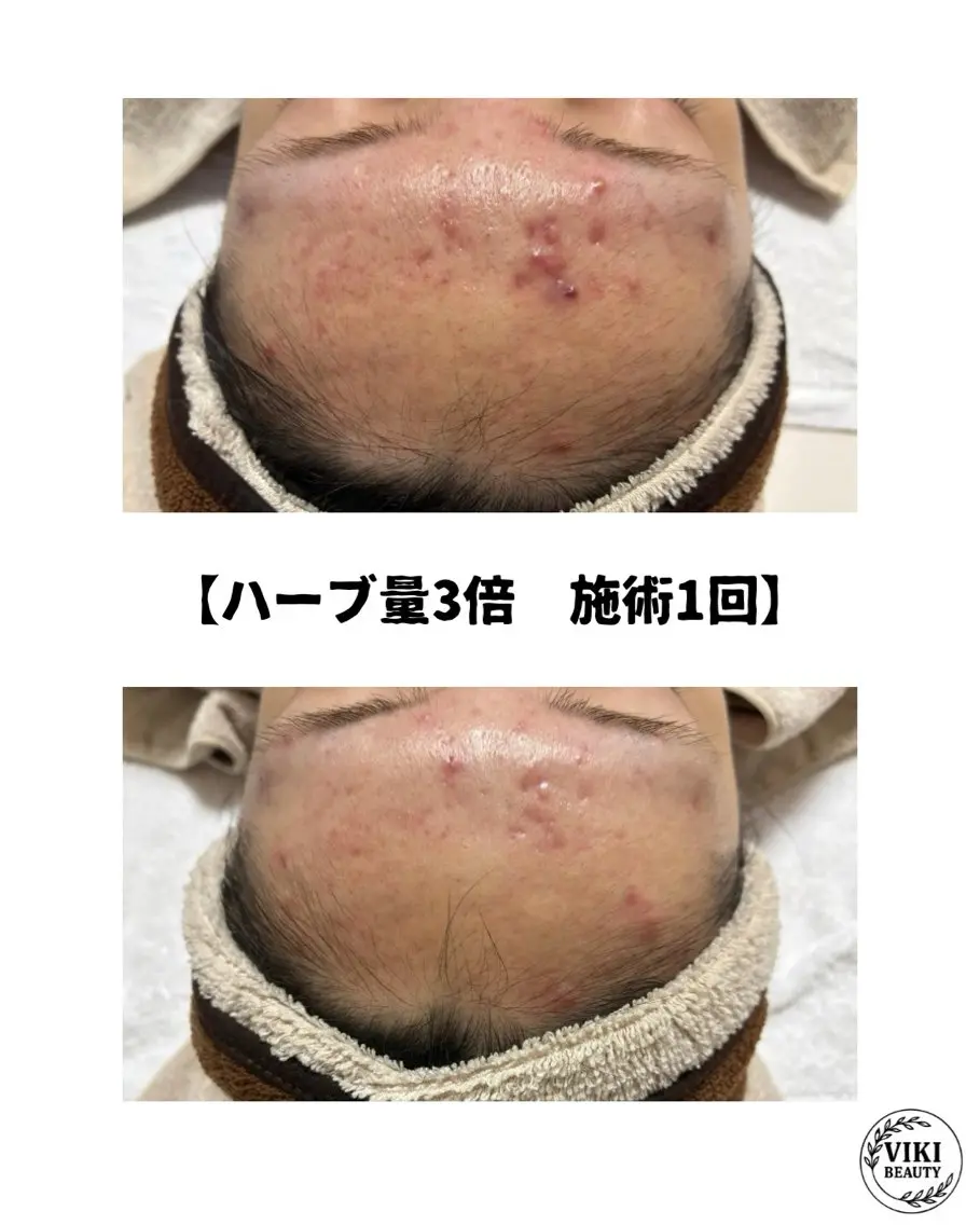 VIKI BEAUTYのエステ・リラクイメージ