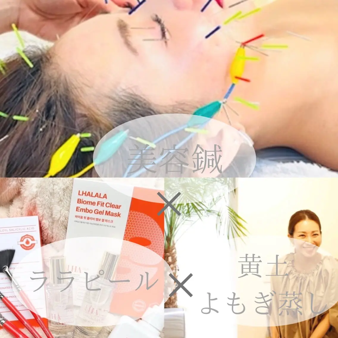 【人気トリプルケア】✨美容鍼＋ララピール✨＋黄土よもぎ蒸し🌿3回モニター募集｜🉐1回14900円の写真