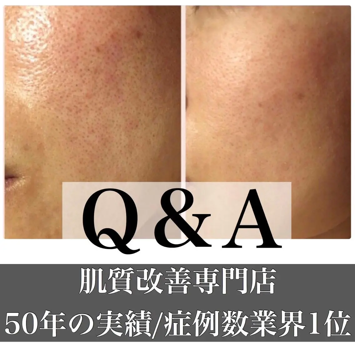 ミディアム カラー パーマ ヘアアレンジ メンズ キッズ ネイル マツエク・マツパ エステ リラク ニキビ・肌質改善専門 ♡人生が変わるサロンのエステ・リラクイメージ