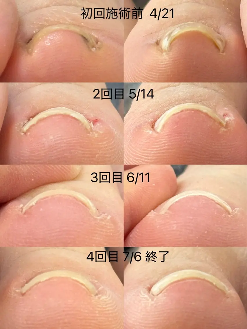 ネイル フットネイル ERINA ♥のその他イメージ