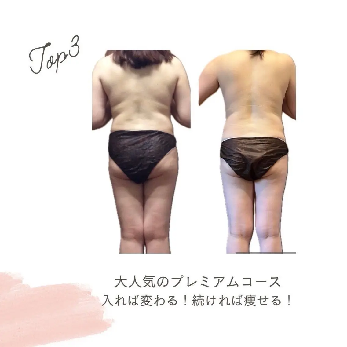新規限定♥【1番人気!理想ボディへの近道】プレミアムコースの写真