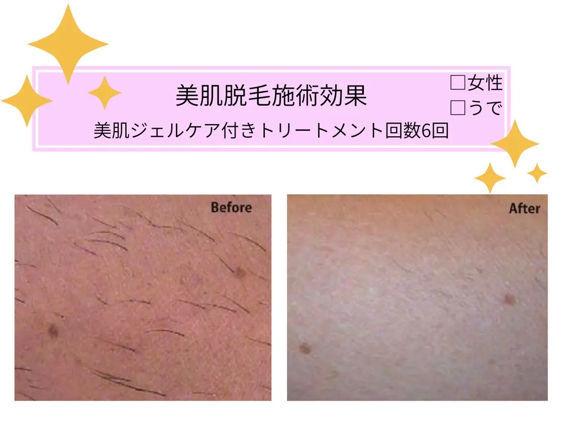 VIKI BEAUTYのエステ・リラクイメージ