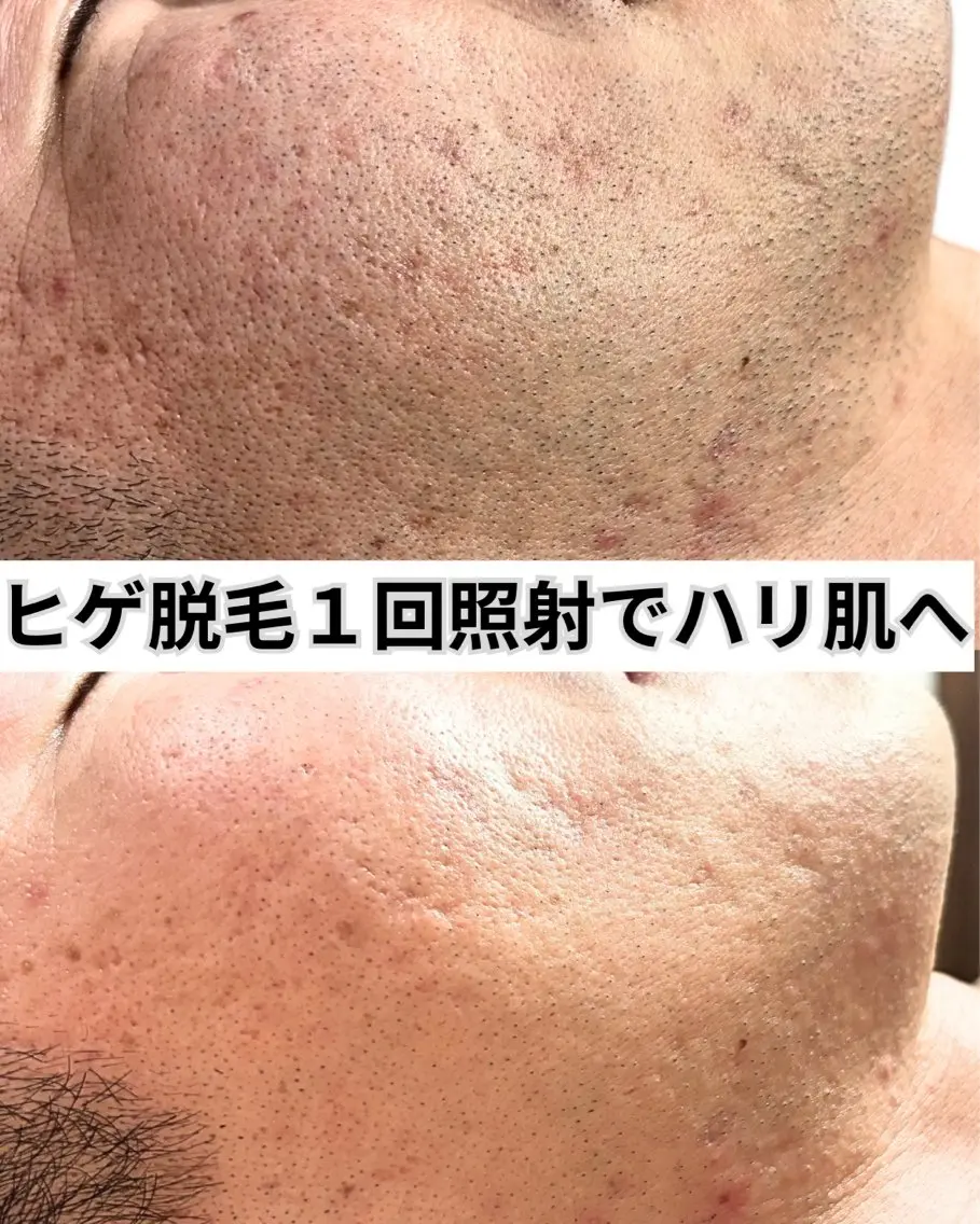 脱毛 脱毛サロン FIS武蔵小杉店のエステ・リラクイメージ