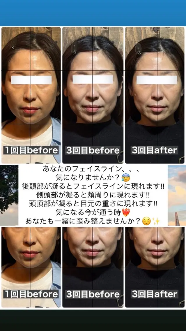 エステ リラク 💎後悔させない小顔 矯正💎イトヤマ🌱のエステ・リラクイメージ