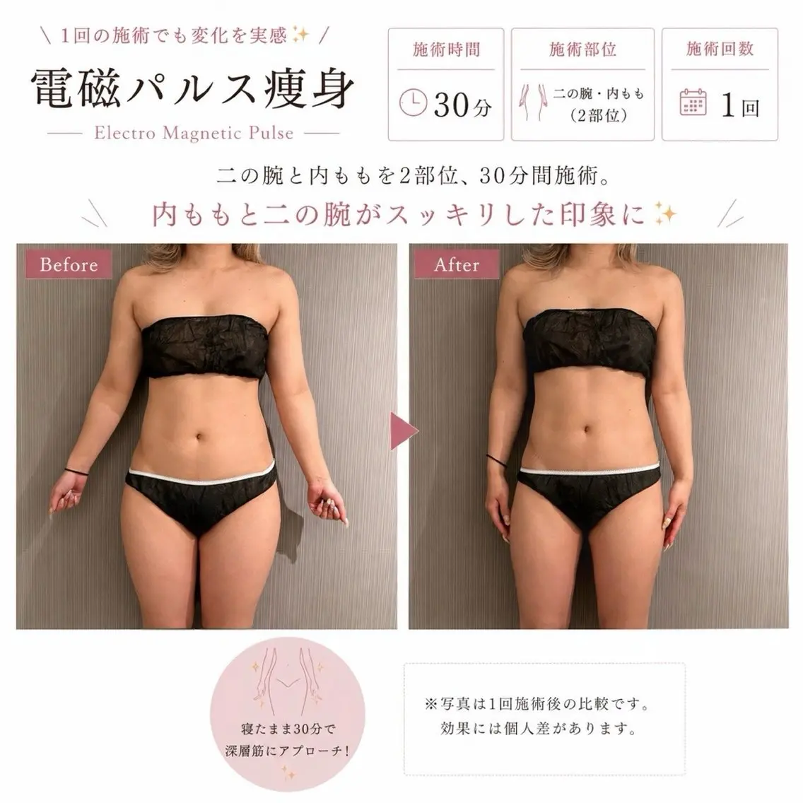 VELA / Miyûのエステ・リラクイメージ