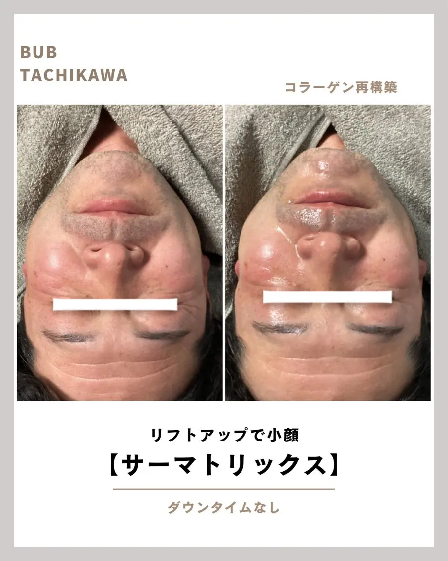 メンズ エステ 【BUB立川】 ゆかのエステ・リラクイメージ