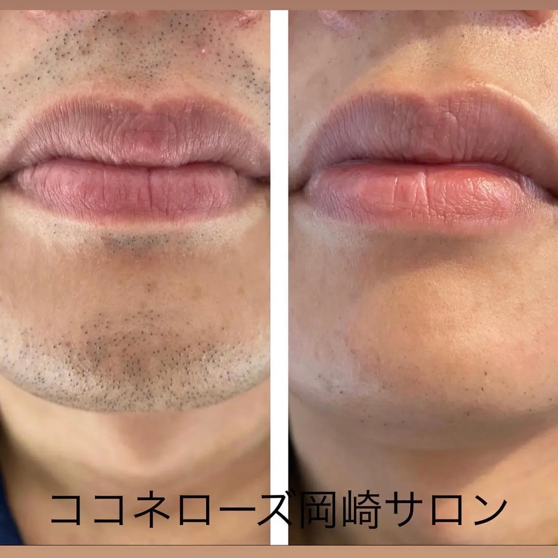 脱毛 ココネローズ 岡崎サロンのエステ・リラクイメージ