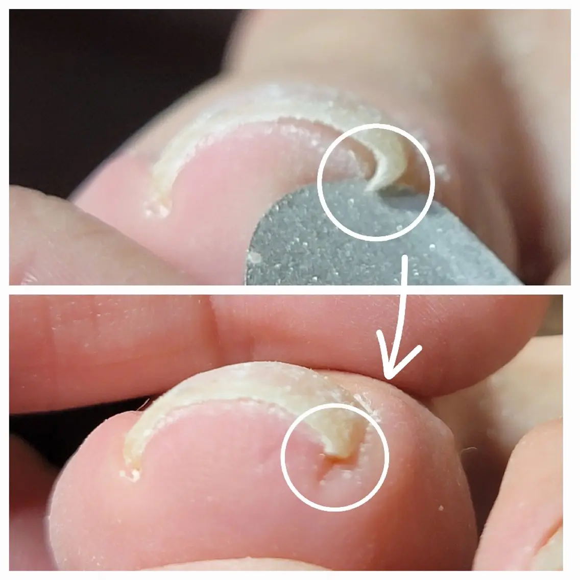 その他(ネイル) ネイル&巻き爪サロン AKnailのネイルデザイン