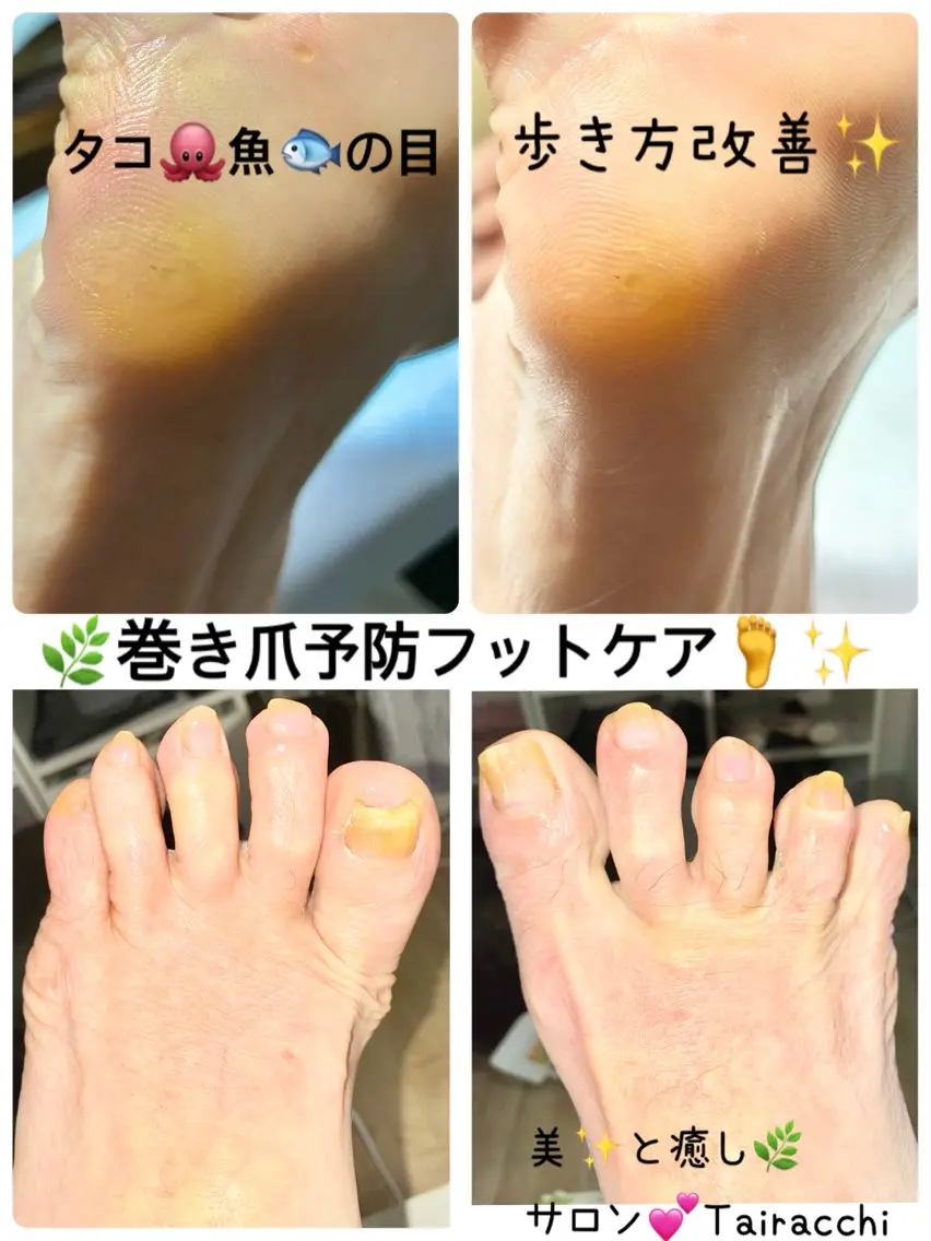 ネイル フットネイル Tairacchi ﾀｲﾗｯﾁのネイルデザイン