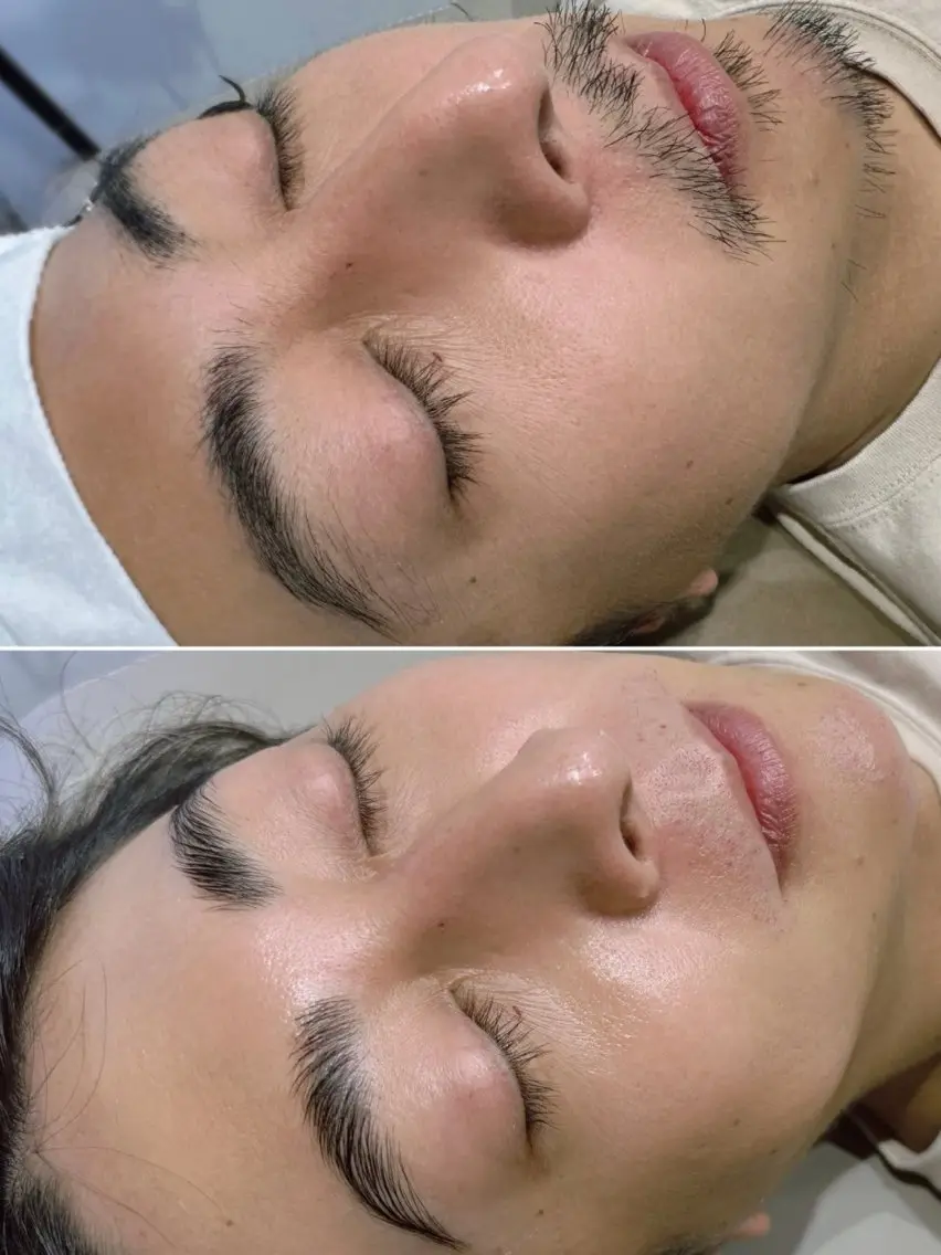 メンズ アイブロウ ワックス脱毛 その他(アイブロウ) 美眉/facewax 🕊️🫧Mのその他イメージ