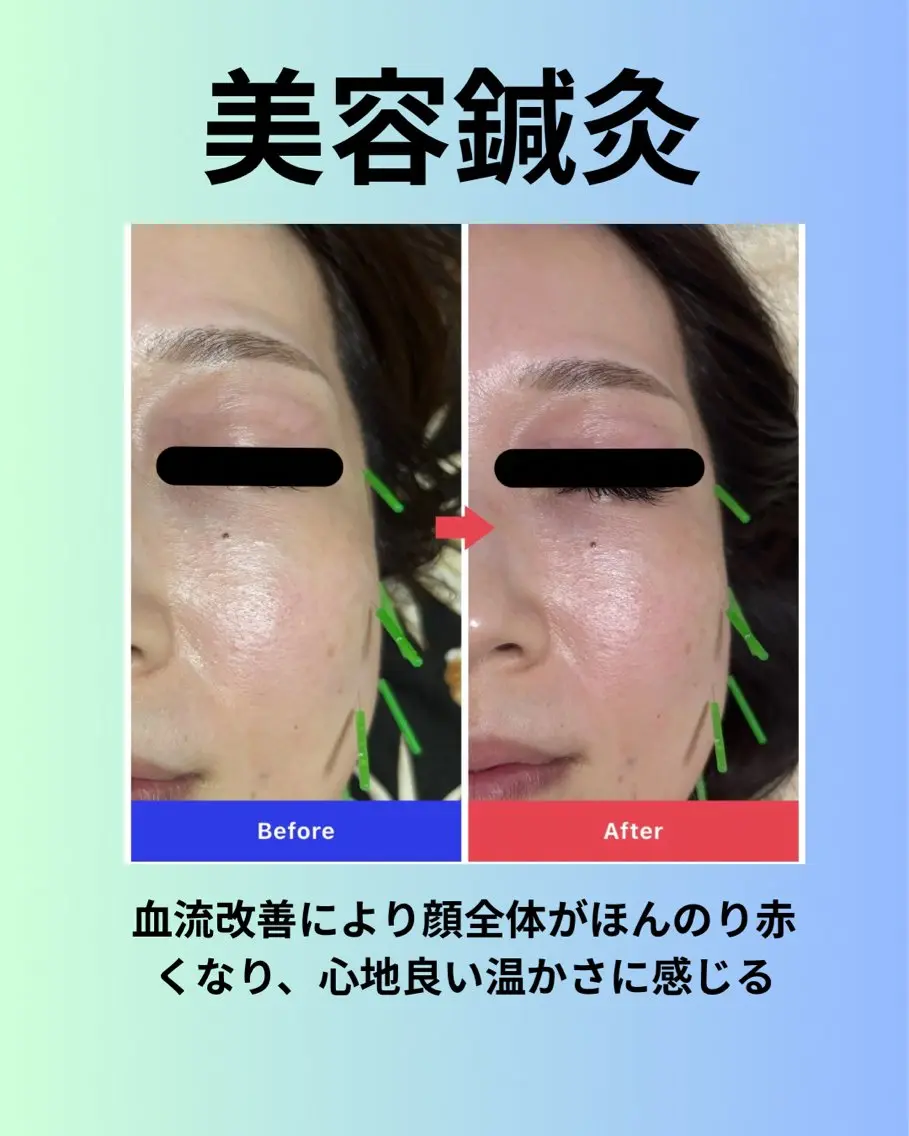あおぞら 鍼灸整骨院のエステ・リラクイメージ