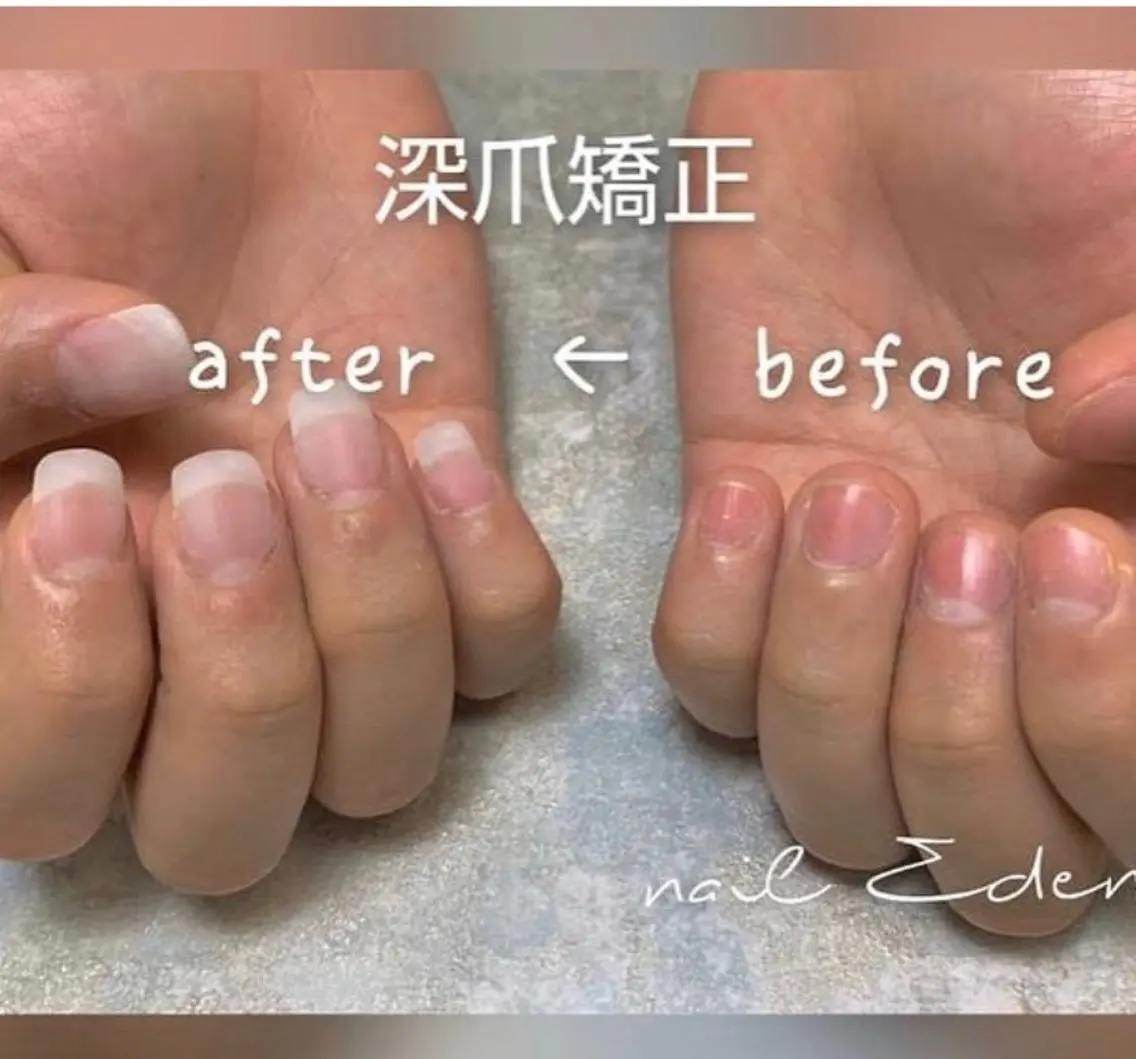 ネイル アートネイル クリアネイル 長さ出し フットネイル フレンチネイル Eden ♾️のネイルデザイン