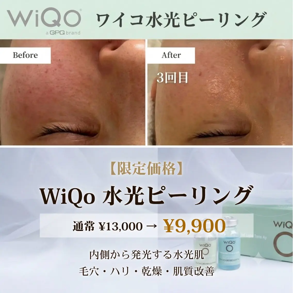 エステ Larugo 肌質改善フェイシャルのエステ・リラクイメージ
