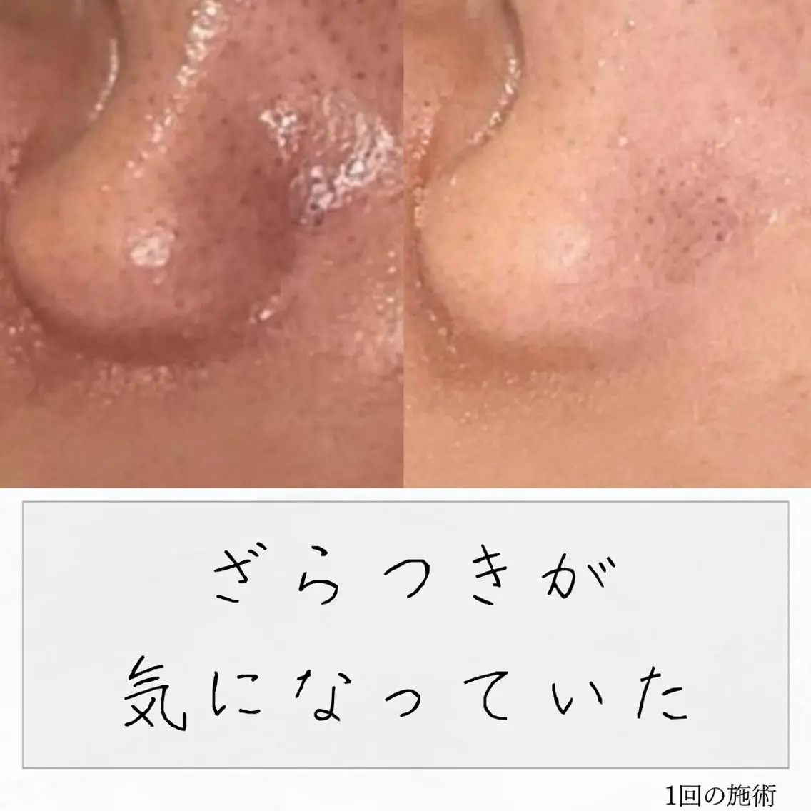 ニキビ経験者が施術 する専門サロン🌻のエステ・リラクイメージ