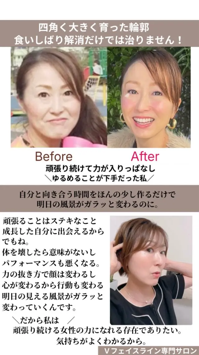 小顔サロン (ラ リュミエール)のエステ・リラクイメージ