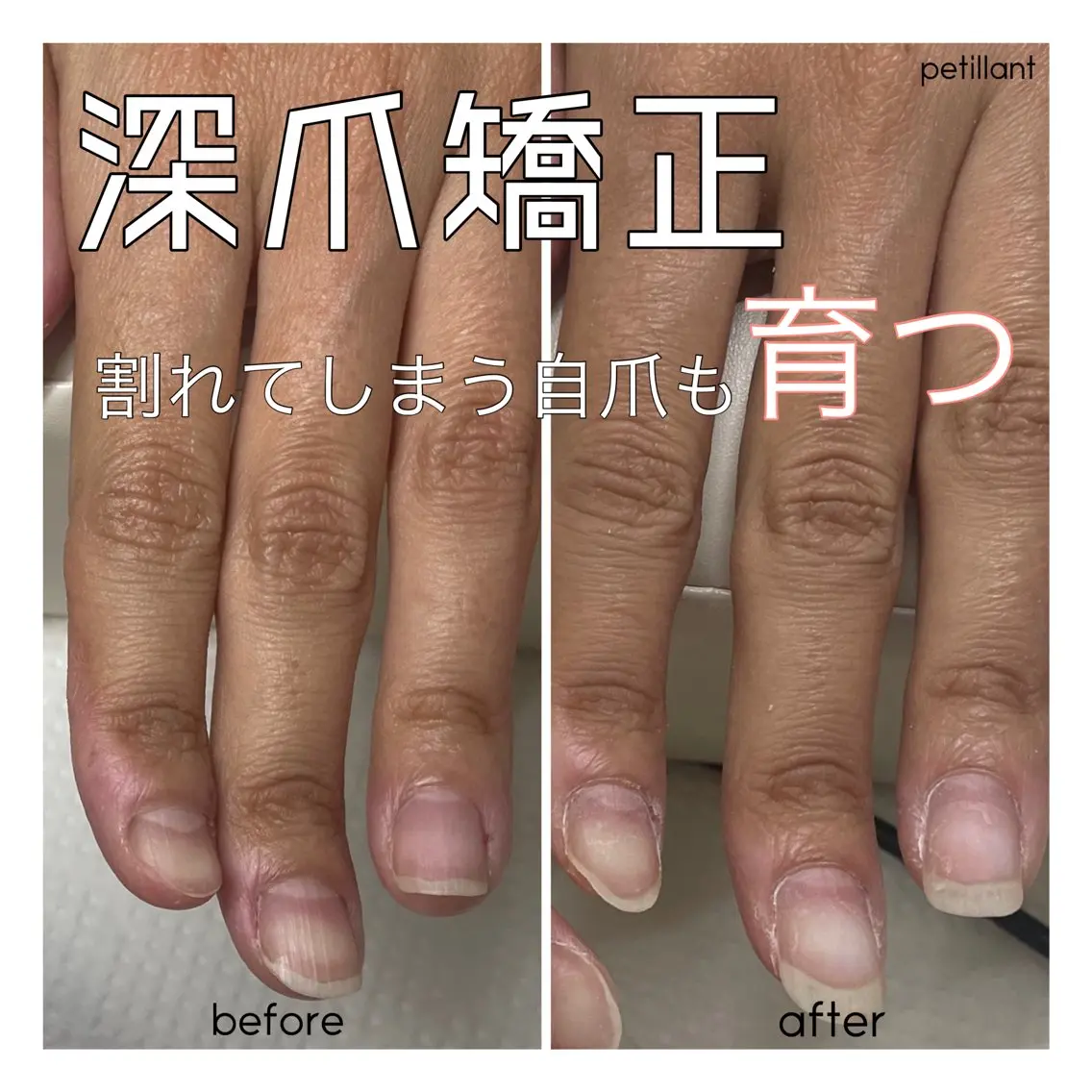 ネイル 長さ出し ジェルネイル nail salon petillantのネイルデザイン