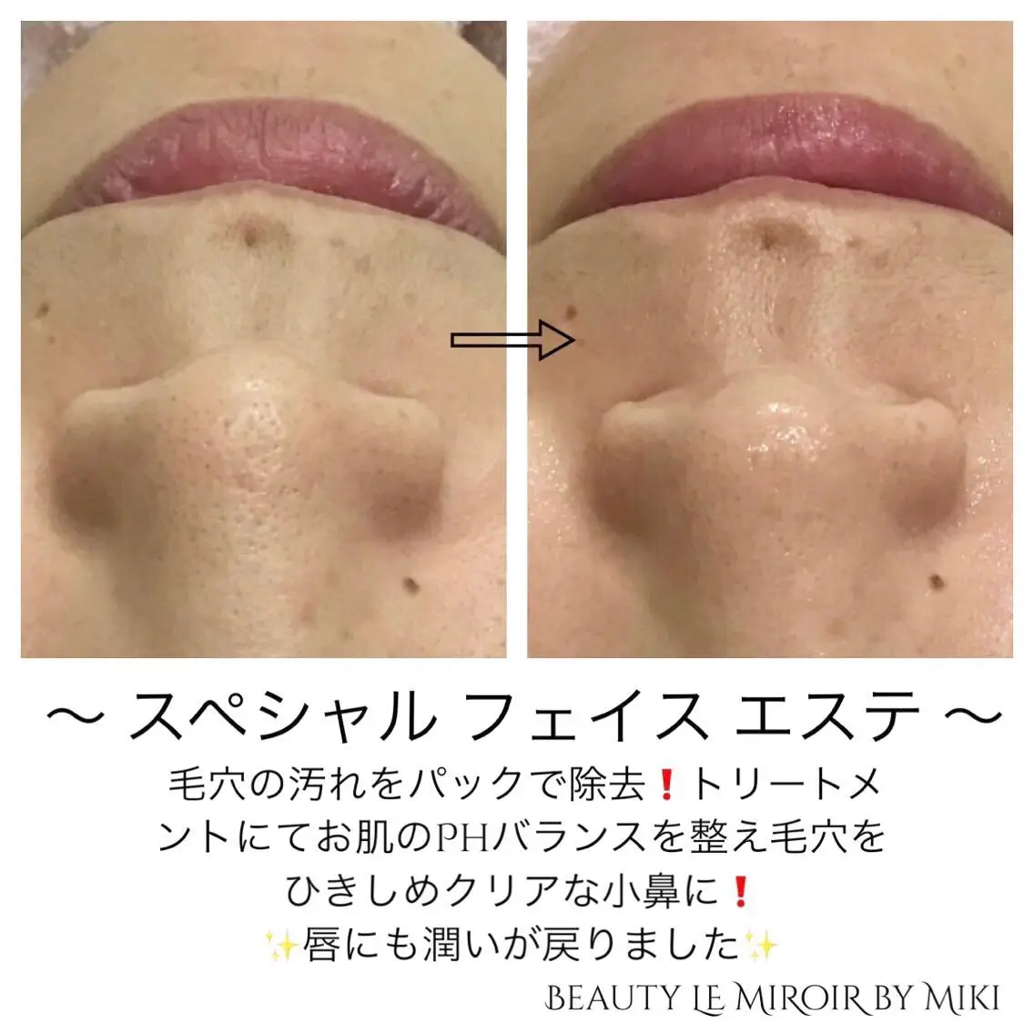 ビューティー ミロワールのエステ・リラクイメージ