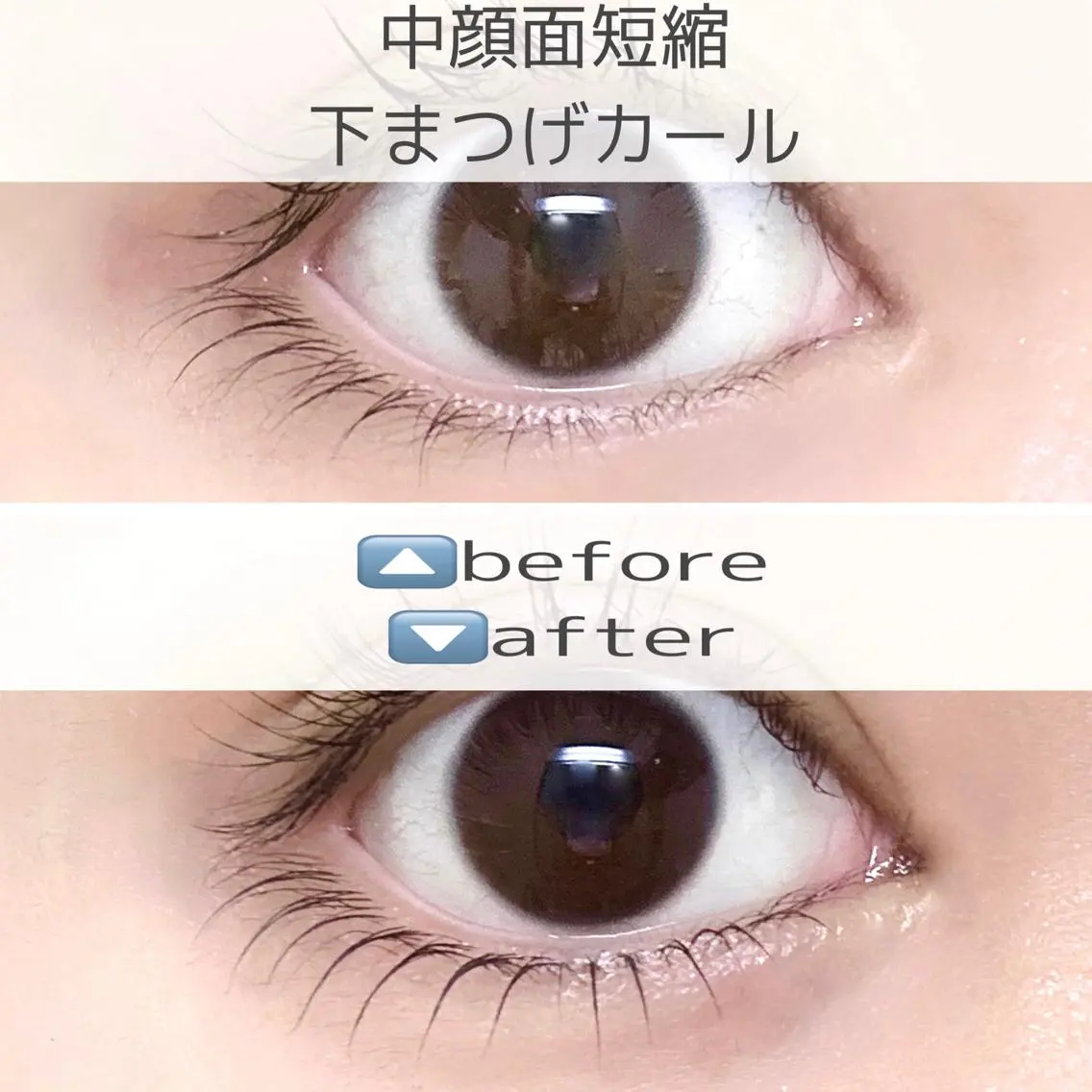 中顔面単純🫧 下まつ毛カールの写真