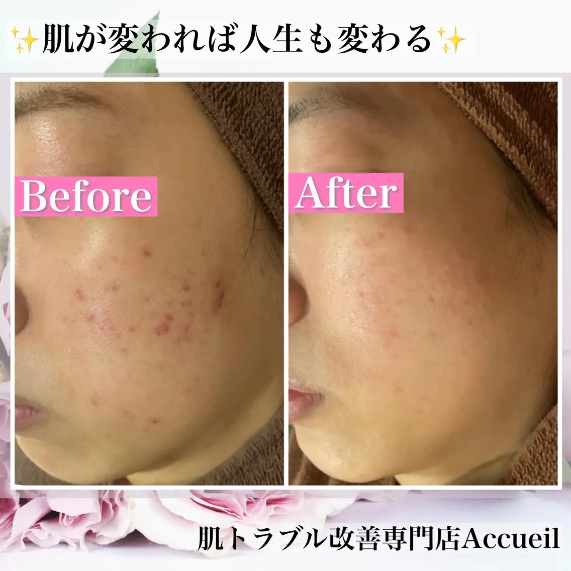 ミディアム カラー パーマ ヘアアレンジ メンズ キッズ ネイル マツエク・マツパ アイブロウ ニキビ・肌質改善専門 ♡人生が変わるサロンのエステ・リラクイメージ