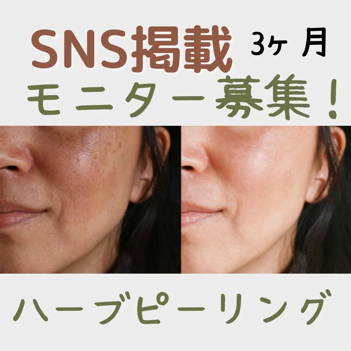 切らない脂肪吸引🔥 Neroliまりこのエステ・リラクイメージ