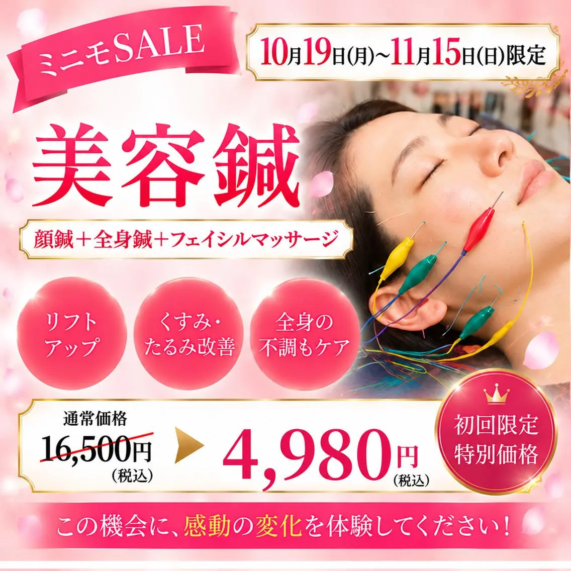 10/19​〜​11/15限定！【人気No.2】【美容鍼】90分⭐️顔針＋身体針+フェイシャルマッサージの写真