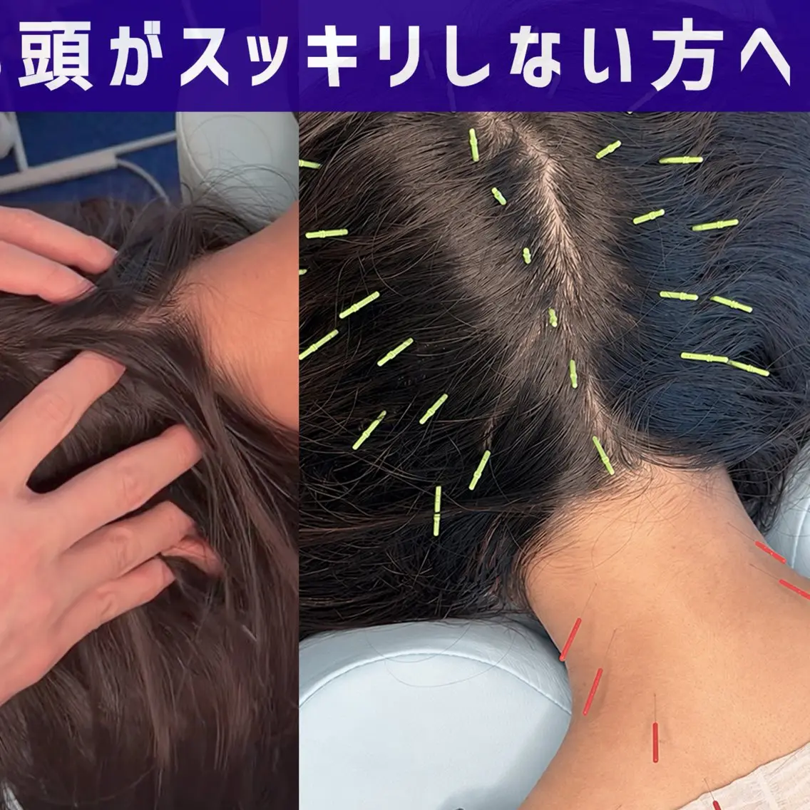リラク 小顔美容鍼 渋谷 YZ 山崎のエステ・リラクイメージ