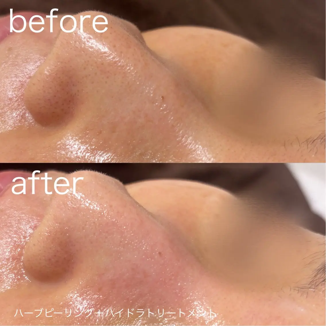 脱毛 lulularico Yuのネイルデザイン